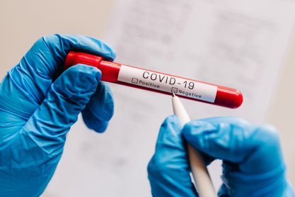 COVID-19. Zmarło prawie 600 osób