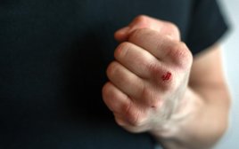 Policjanci ustalili i zatrzymali sprawców pobicia 21-latka w Jaśle